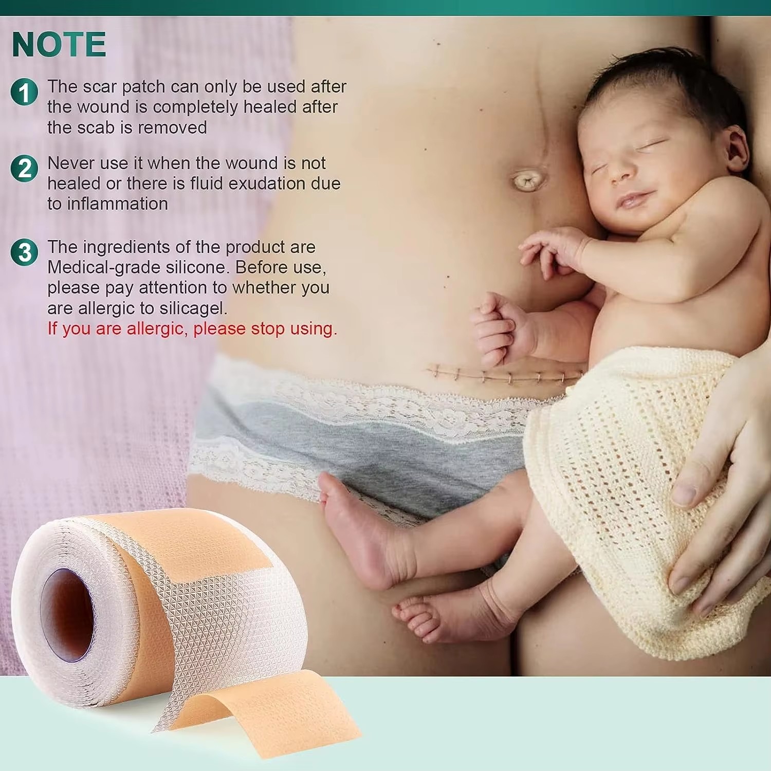 50/100/150cm silicone gel cica - Medical Tape avaliação e preço